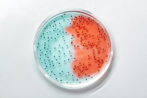 Close-up of vibrant blue and red bacteria cultures in a petri dish as an example of SIBO breath tests